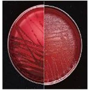 BBL Prepared Media Brucella Agar Plate Bx