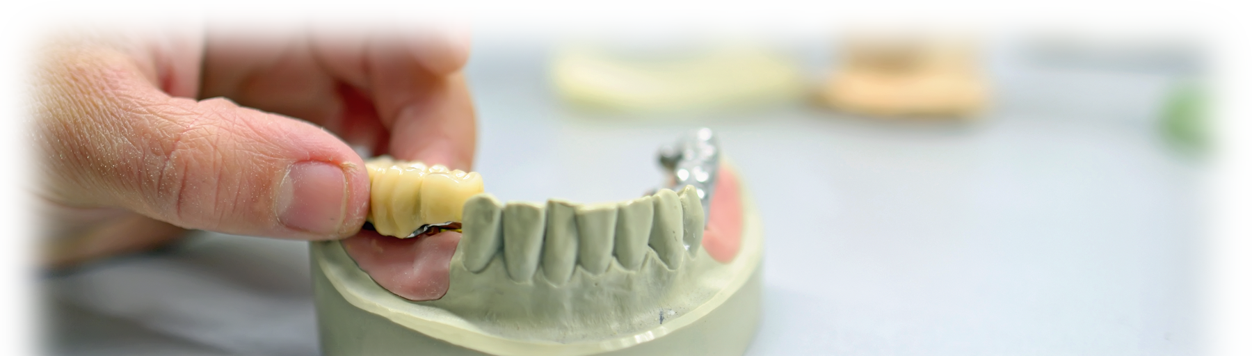 Epoxy & Polyurethane Die Materials