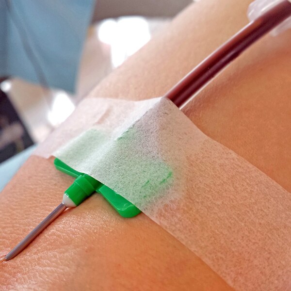 Fistula Needles